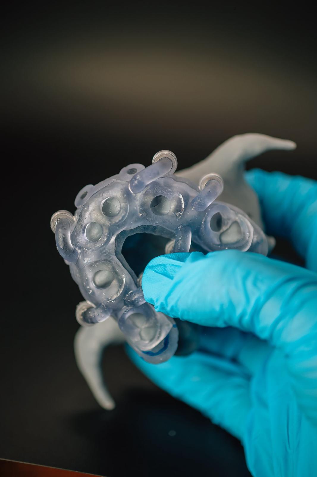 A surgical guide reference view held in a gloved hand.